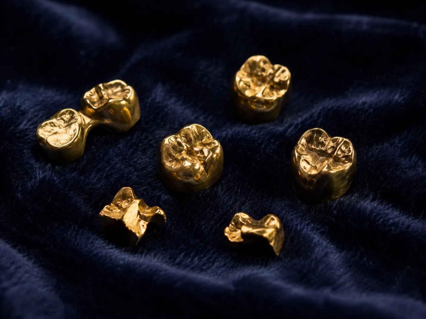 Goldkronen und Goldbrücken auf dunkelblauem Samt – Zahngold-Ankauf